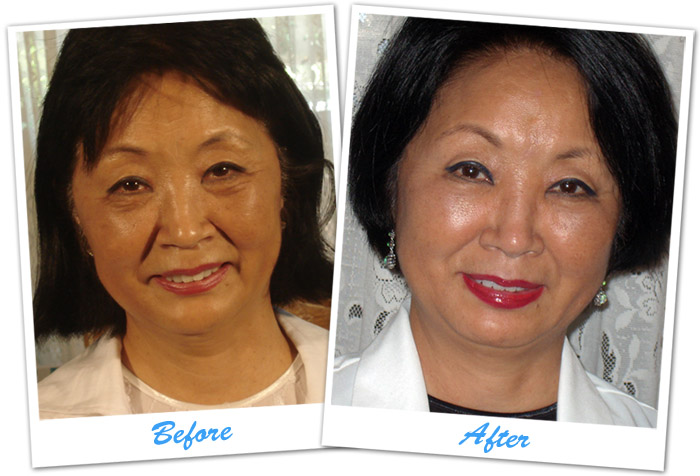 Life Cell Before and After Case Study