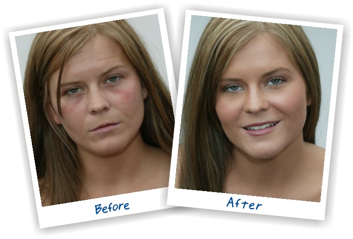 Life Cell Before and After Case Study